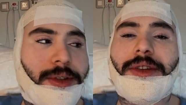 عبدالله القفاري في أحدث ظهور له بعد عملية التجميل .. فيديو