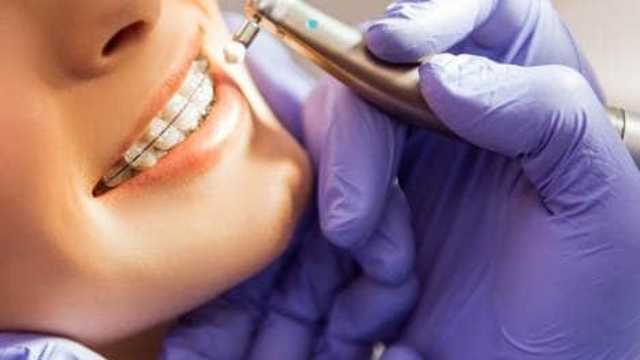 مقاضاة طبيب أسنان أجرى 32 عملية لـ امرأة في يوم واحد