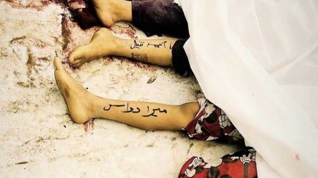 أسماؤهم على أشلائهم.. آباء يكتبون بالحبر على أجساد أطفالهم في غزة (شاهد)