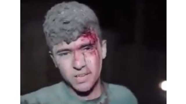 إشادة بثبات فتى فلسطيني خرج جريحا من تحت الركام متوعدا الاحتلال (شاهد)