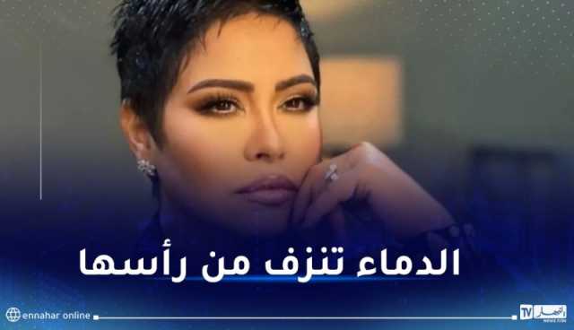 صورة صادمة لشيرين بعد إعتداء حسام حبيب عليها!