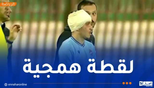 لاعب وفاق سطيف يتعرض للرشق بالحجارة على مستوى رأسه