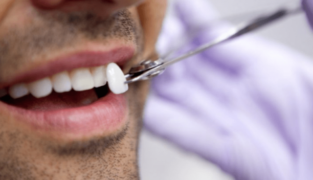 العمل على دواء يعيد نمو الأسنان التالفة من جديد