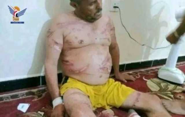 ادانات واسعة لتعذيب وقتل المواطن محمد مهدي من قبل المرتزقة في ابين