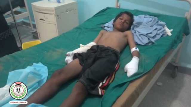 اصابة طفل بانفجار قنبلة عنقودية في الجوف