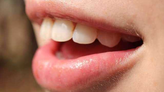 دراسة: العناية بالأسنان تقي من أمراض الدماغ