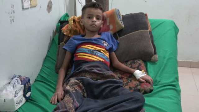 انتشار مرعب لمرض الحصبة والحمى بين الأطفال في عدن والمحافظات المجاورة