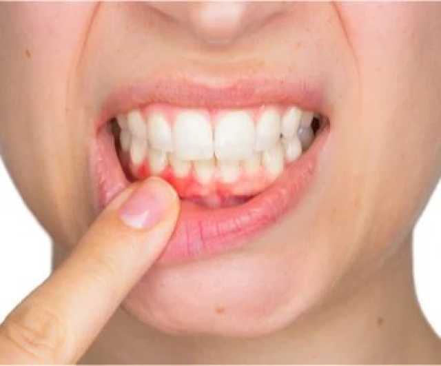 6 نصائح للحفاظ على صحة الأسنان