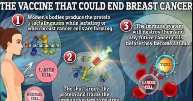 ثورة لمواجهة سرطان الثدى.. لقاح تجريبى يمكنه القضاء على المرض بحلول 2030 صحة وطب