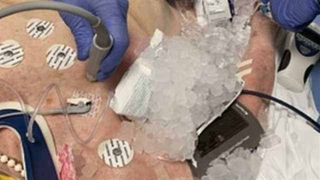 شاهد.. أطباء يستخدمون أكياس الثلج لعلاج مرضى ارتفاع درجات الحرارة بأمريكا منوعات
