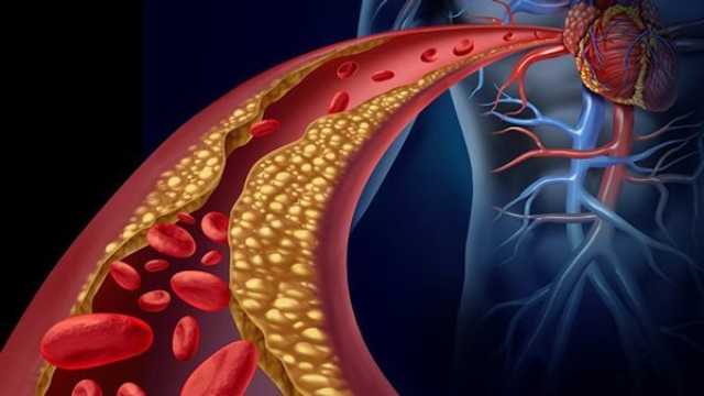 3 عوامل غير متوقعة تساعد على خفض نسبة الكوليسترول- تفاصيل مرأة