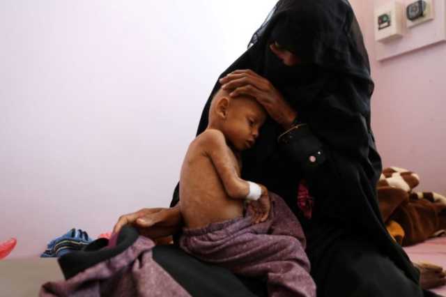 الأمم المتحدة: ربع سكان اليمن بحاجة إلى دعم ورعاية الصحة النفسية بسبب الحرب