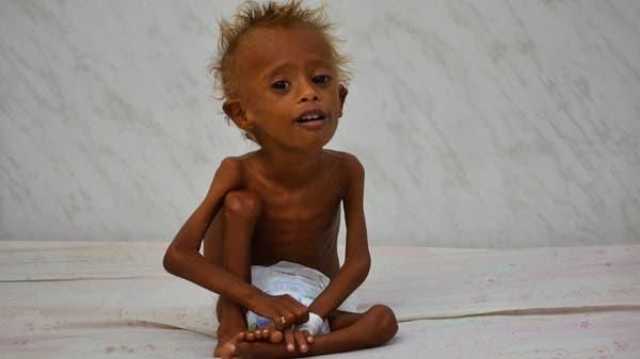 ملايين اليمنيين يواجهون مستويات عالية من انعدام الأمن الغذائي