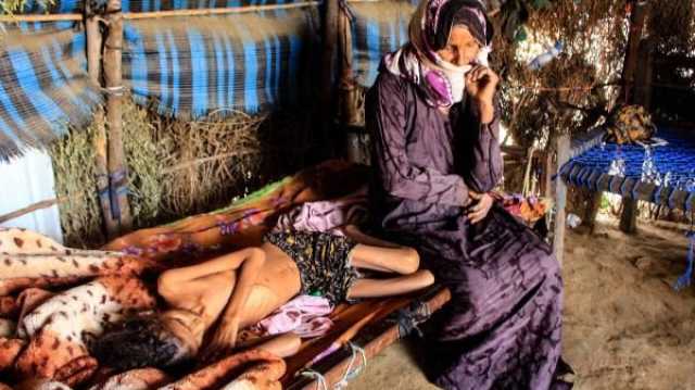 اليمن: قرابة 8 ملايين طفل وامرأة حامل ومرضعة في 13 محافظة يعانون من سوء التغذية الحاد