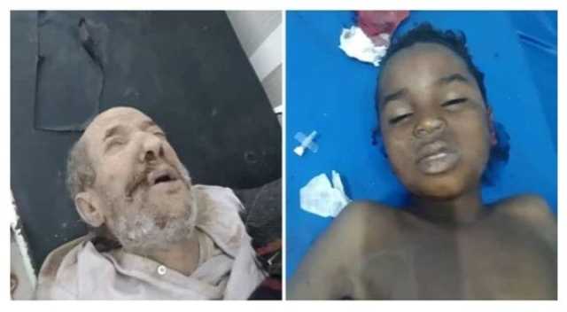 مجلس واتحاد مهمشي اليمن يدين مقتل 5 من أبنائه بقذيفة حوثية استهدفت مسعفي جرحى مجزرة رداع