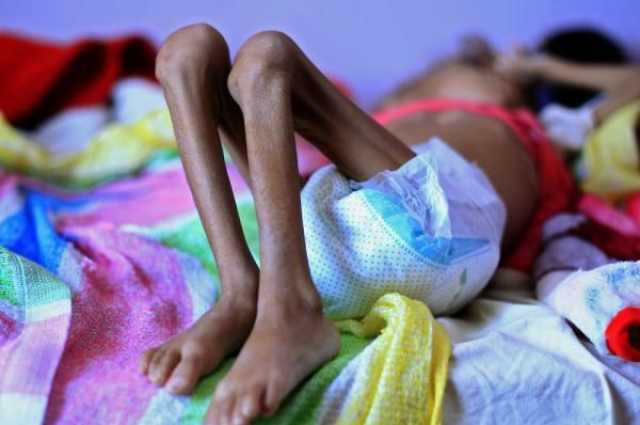 ارتفاع مستوى انعدام الأمن الغذائي في مناطق الحكومة اليمنية