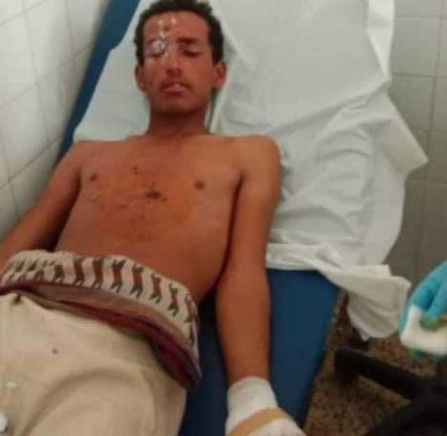 إصابة مدني بانفجار مقذوف حوثي في البيضاء
