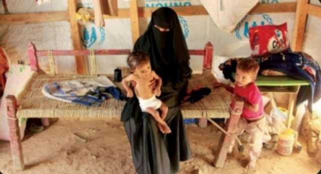معدلات سوء التغذية في اليمن هي الأعلى على الإطلاق وطفل يموت كل 10 دقائق بسبب الجوع
