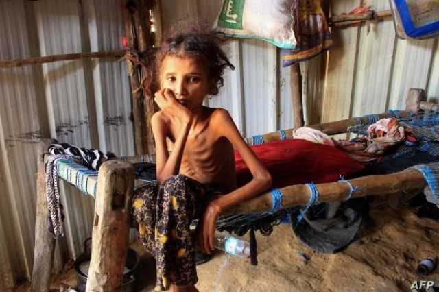 تقرير أممي يتوقع تزايد معدلات انعدام الأمن الغذائي في اليمن