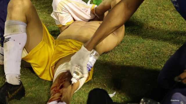 فيديو.. شرطي يطلق النار على لاعب بعد مباراة كرة قدم في البرازيل