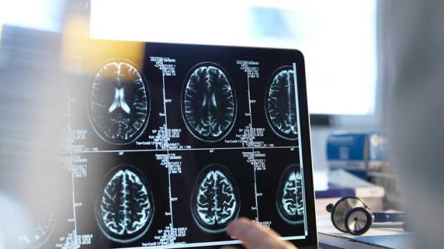 الصين تبتكر روبوتاً يزحف داخل دماغ الإنسان