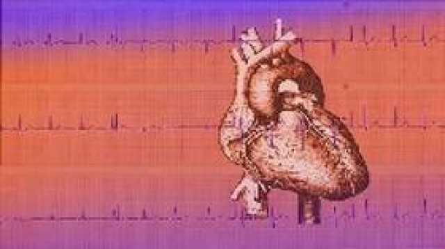 روسيا.. طريقة جديدة لتشخيص أمراض القلب والأوعية الدموية