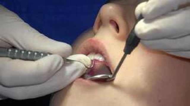 عادات تلحق الضرر بالأسنان