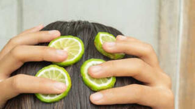 أطباء يحذرون من مخاطر 'ترند' فرك الليمون على الشعر