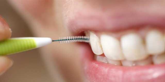 ماهي المنتجات المسببة لتراكم الجير على الأسنان؟