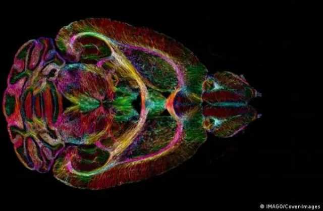 إنجاز كبير.. علماء يكشفون خرائط جديدة للدماغ تساهم في حل ألغازه