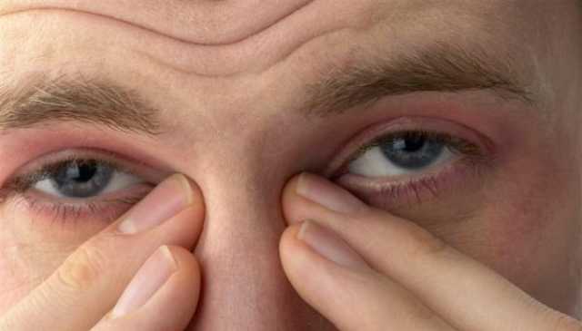الصداع النصفي العيني.. ما هي أسبابه وأعراضه؟