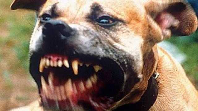 من فصيلة بيتبول.. كلب شرس يهجم على سيدتين وينهش جسديهما بمارتيل(فيديو)