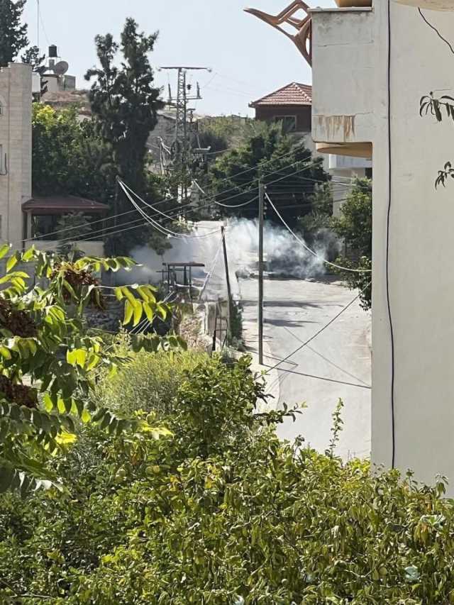 عشرات الإصابات بمواجهات مع قوات الاحتلال في طولكرم
