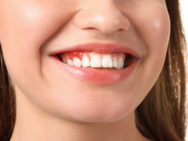 5 مسببات تفسد الأسنان.. عليك تجنبها