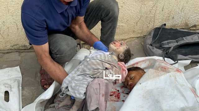 الصحة: 28 شهيدا و69 إصابة خلال الـ24 ساعة الماضية في غزة
